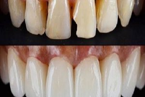 sMILE dESIGN